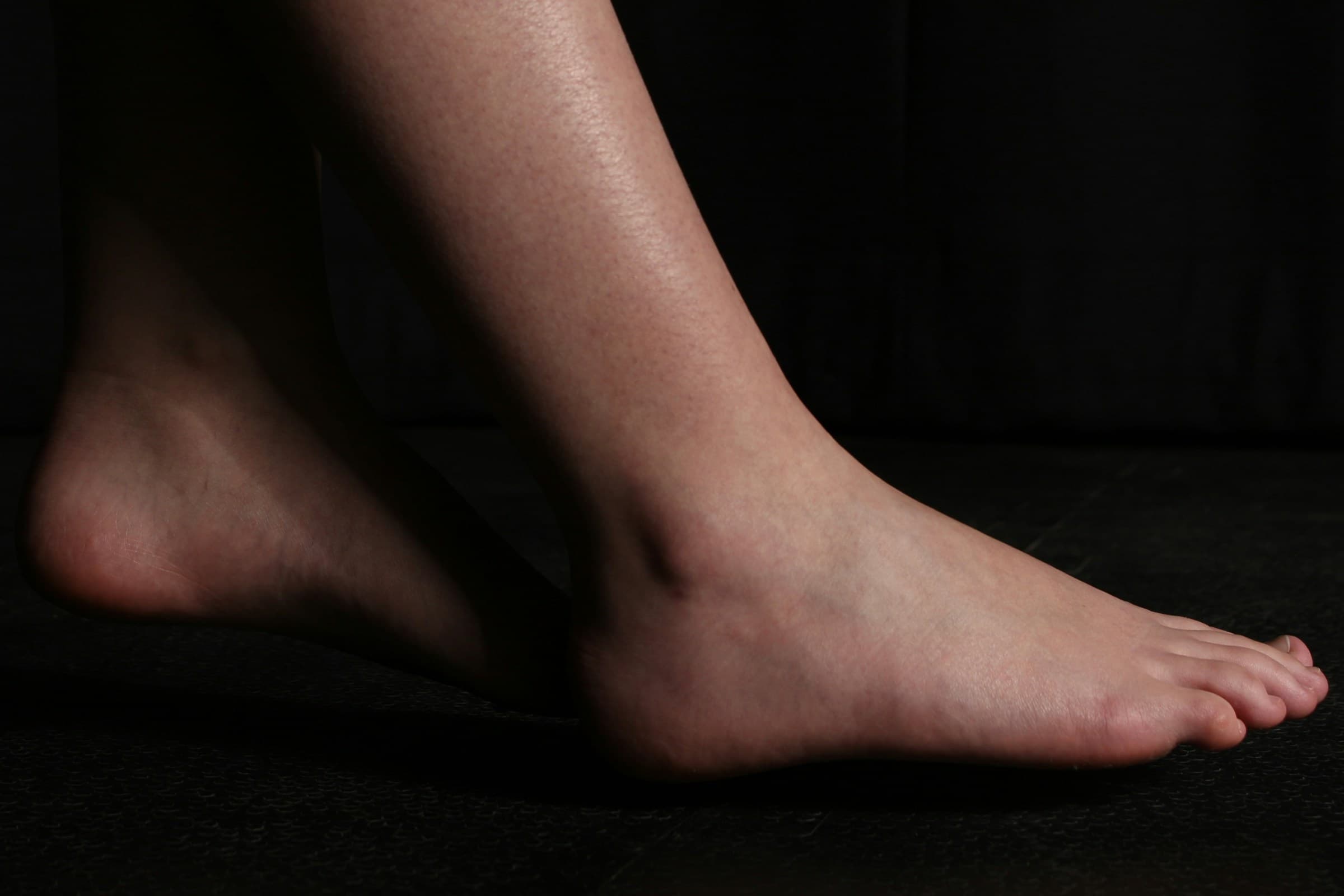MRI Ankle